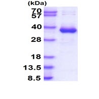 CYB5R3 Recombinant Protein